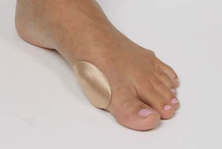 Gel Button for Bunions — Podiatrists in Alice Springs, NT
