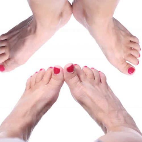In turned & out turned feet Baby Feet — Podiatrists in Alice Springs, NT